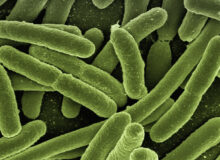 Lebensmittelvergiftung durch Kolibakterien / Quelle: Pixabay, lizenzfreie Bilder, open library; geralt:https://pixabay.com/de/photos/koli-bakterien-escherichia-coli-123081/